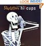 Skeleton Hiccups