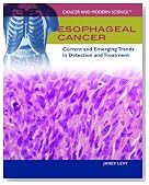 Esophageal Cancer: Current and Emerging Trends in Detection and Treatment (Cancer and Modern Science)
