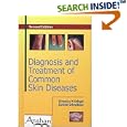 Diagnosis and Treatment of Common Skin Diseases by Virendra N., M.D. Sehgal, and Govind Srivastava