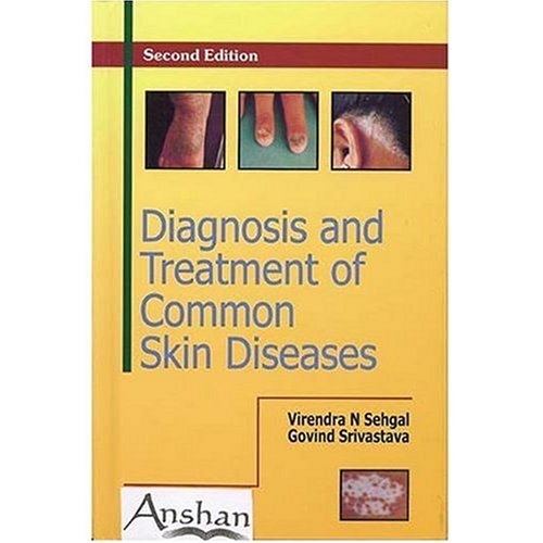 Diagnosis and Treatment of Common Skin Diseases