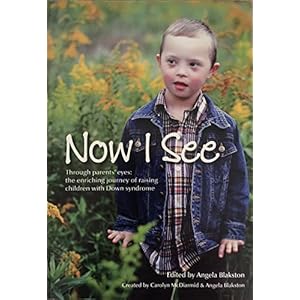 Now I See: The Enriching Journey of Raising Children with Down Syndrome