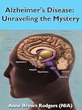 Complete Guide for Alzheimers Disease; Symptoms, Signs, Diagnosis and Treatments