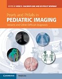 Pearls and pitfalls in pediatric imaging : variants and other difficult diagnoses