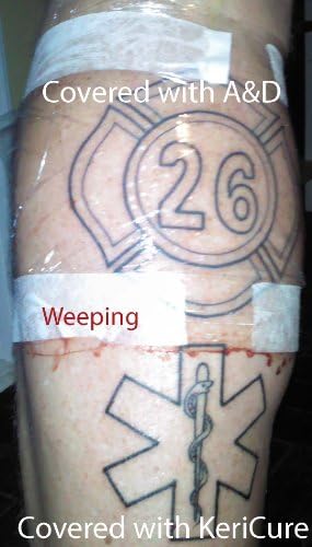 KeriCure's Tat Seal, Spray on Protective Barrier for Tatoo After Care