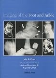 Imaging of the foot and ankle