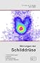 St�rungen der Schilddr�se: Was man �ber die Schilddr�se wissen sollte. St�rungen, Ursachen, Heilbehandlung, Warnung vor jodiertem Salz
