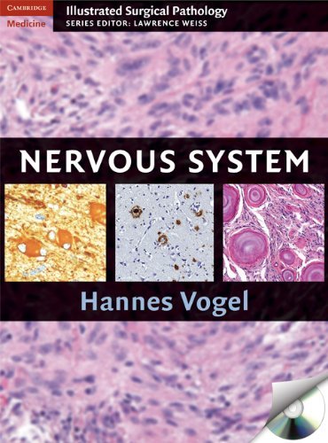 Nervous System (Cambridge Illustrated Surgical Pathology) On Sale