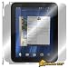 ArmorSuit MilitaryShield – HP TouchPad Skin Protector Shield Full Body with LIFETIME REPLACEMENTS