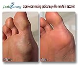 Rechargeable Water Resistant Electric Callus Remover - Foot File for Scrubbing Feet, Micro-Pedi Foot Care Tool - Gently & Effectively Shaves and Buffs Away Dead, Hard Skin, Dry Callused Feet and Cracked Heels - For Men and Women - 3 Pumice Stone Rollers Included - Experience Pedicure Spa Like Results In Seconds!