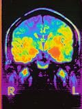 Magnetic Resonance Imaging MRI of Head Photographic Poster Print, 30x40