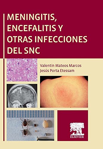 Meningitis, encefalitis y otras infecciones del SNC (Spanish Edition)