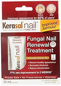 kerasal foot ointment toenail fungus