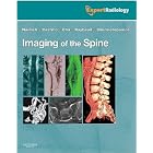 Click here to buy Imaging of the Spine: Expert Radiology Series, Expert Consult-Online and Print by Mauricio Castillo MD, Charles Raybaud MD, James G. Smirniotopoulos MD, and Soonmee Cha MD.