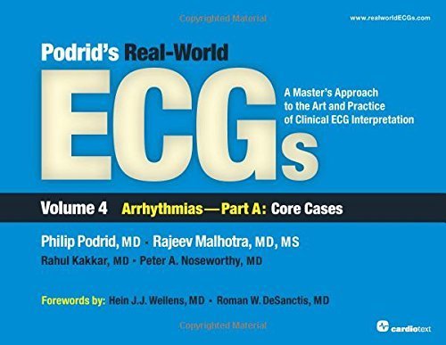 Podrid's Real-World ECGs: A Master's Approach to the Art and Practice of Clinical ECG Interpretation. Volume 4A, Arrhythmias: Core Cases 1st Edition by Philip Podrid, Rajeev Malhotra, Rahul Kakkar, Peter A. Nosew (2015) Paperback