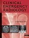 Emergency Medicine Residency Book List