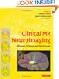 Clinical MR Neuroimaging: Diffusion, Perfusion and Spectroscopy