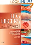 Leg Ulcers: A Problem-Based Learning...