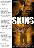 Skins