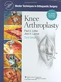Knee arthroplasty
