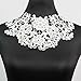 Yontree Venise Lace Applique
