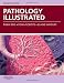 Pathology Illustrated