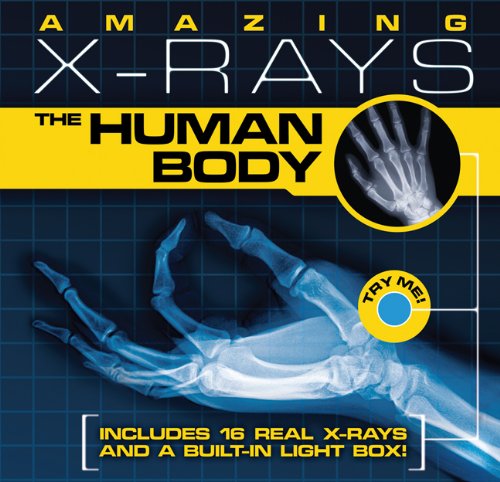 Amazing X-rays: The Human Body Amazing X-rays: The Human Body