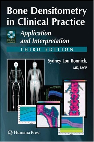 Bone Densitometry in Clinical Practice: Application and Interpretation (Current Clinical Practice)