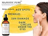 Majestic Pure Vitamin C Serum L-ascorbic Acid for Age Spots,Wrinkles, Sun Damage and Dark Circles Under the Eyes, 1 Fluid Ounce