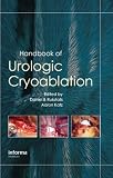 Handbook of Urologic Cryoablation