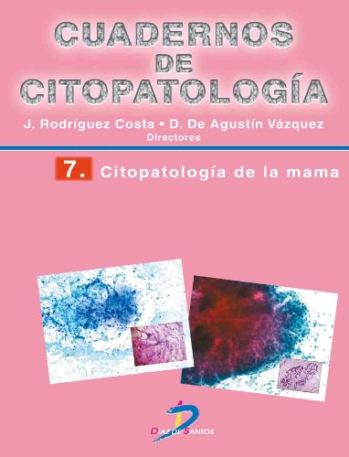Citopatología de la mama (Cuadernos de Citopatología) (Spanish Edition)