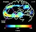 Genes and Disease - The Nervous System