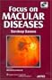 Focus on Macular Diseases: Co-Published by Jaypee Brothers and Lippincott Williams & Wilkins
