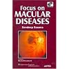Focus on Macular Diseases: Co-Published by Jaypee Brothers and Lippincott Williams & Wilkins