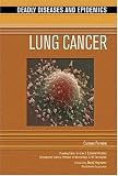 Lung Cancer (Deadly Diseases and Epidemics)