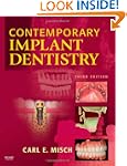 Contemporary Implant Dentistry, 3e