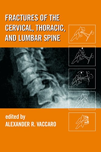 Fractures of the Cervical, Thoracic, and Lumbar Spine (Mechanical Engineering)