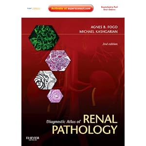 Diagnostic Atlas of Renal Pathology: Expert Consult - Online and Print