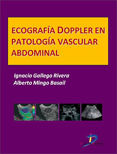 Ecografía Doppler en Patología vascular abdominal  (Este capítulo pertenece al libro Tratado de ultrasonografía abdominal) (Spanish Edition)