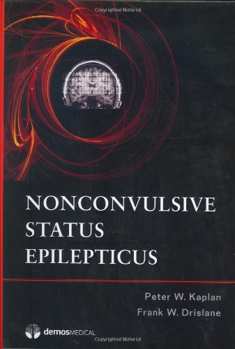 Nonconvulsive Status Epilepticus