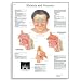 3B Scientific VR1251L Glossy Laminated Paper Rhinitis and Sinusitis Anatomical Chart, Poster Size 20" Width x 26" Height