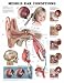 Middle Ear Conditions Anatomical Chart