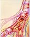 Photographic Print of Artwork of chronic obstructive pulmonary disease from Science Photo Library