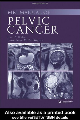 MRI Manual of Pelvic CancerFrom CRC Press
