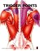 Trigger Points: Understanding Myofascial Pain and Discomfort