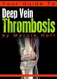 Your Guide To Deep Vein Thrombosis