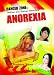 Anorexia (Danger Zone: Dieting and Eating Disorders)