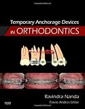Temporary Anchorage Devices in Orthodontics, 1e