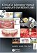 Clinical and Laboratory Manual of Implant Overdentures