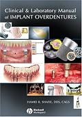 Clinical and Laboratory Manual of Implant Overdentures