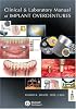 Clinical and Laboratory Manual of Implant Overdentures